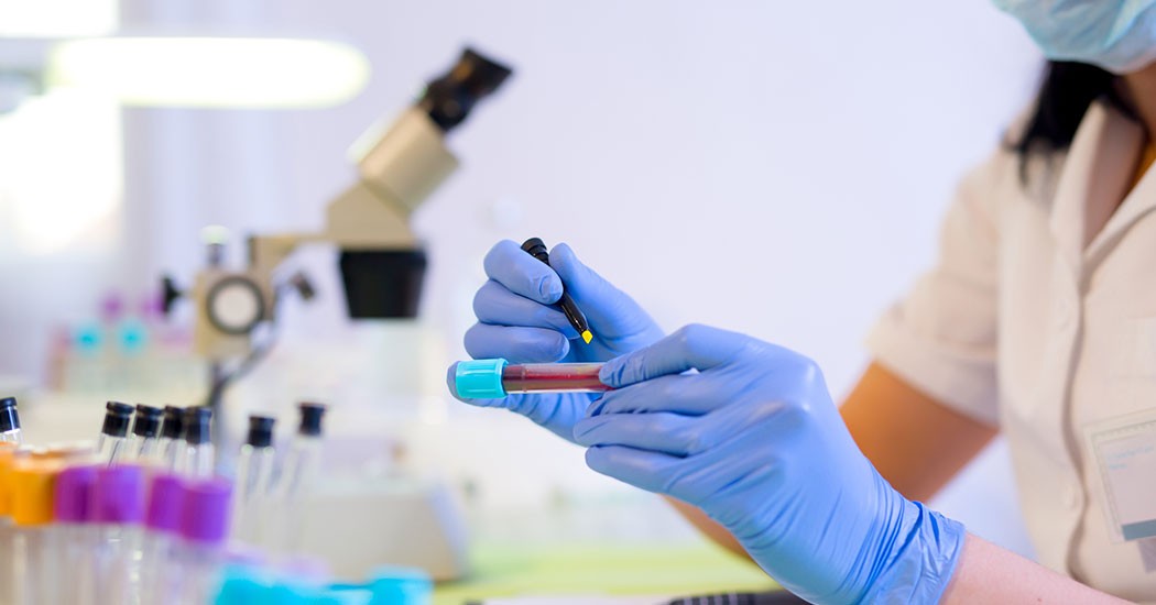 Про проведення обстеження на SARS CoV-2